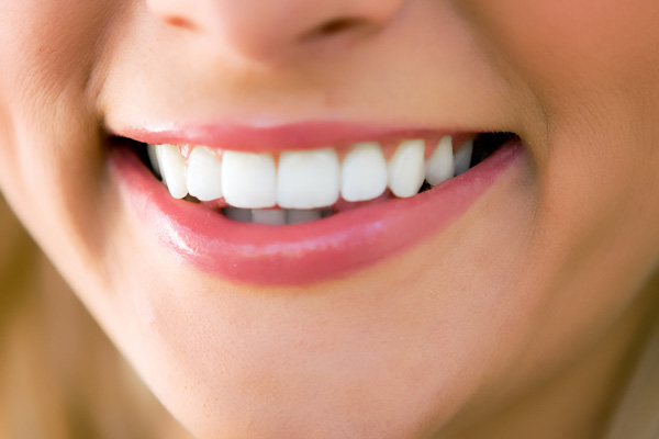 White teeth with gorgeous smile